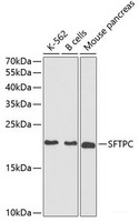 Western blot analysis of extracts of various cell lines using SFTPC Polyclonal Antibody at dilution of 1:1000.