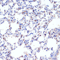 Immunohistochemistry of paraffin-embedded Rat lung using SFTPC Polyclonal Antibody at dilution of 1:200 (40x lens) .