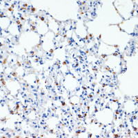 Immunohistochemistry of paraffin-embedded Mouse lung using SFTPC Polyclonal Antibody at dilution of 1:200 (40x lens) .