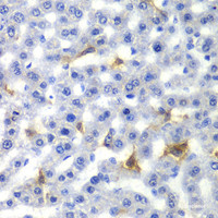 Immunohistochemistry of paraffin-embedded Rat liver using NR0B2 Polyclonal Antibody at dilution of 1:100 (40x lens) .