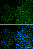 Immunofluorescence analysis of U2OS cells using NR0B2 Polyclonal Antibody