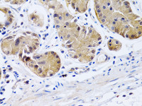 Immunohistochemistry of paraffin-embedded Human stomach using PTGIR Polyclonal Antibody at dilution of 1:200 (40x lens) .