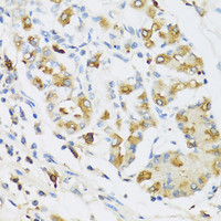 Immunohistochemistry of paraffin-embedded Human stomach using RNASE3 Polyclonal Antibody at dilution of 1:100 (40x lens) .