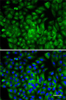 Immunofluorescence analysis of A-549 cells using ATG16L1 Polyclonal Antibody