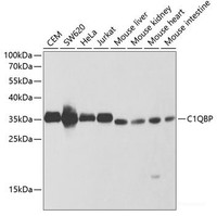 Western blot analysis of extracts of various cell lines using C1QBP Polyclonal Antibody at dilution of 1:1000.