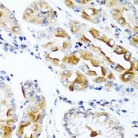 Immunohistochemistry of paraffin-embedded Human stomach using CCL21 Polyclonal Antibody at dilution of 1:100 (40x lens) .
