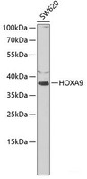 Western blot analysis of extracts of SW620 cells using HOXA9 Polyclonal Antibody at dilution of 1:1000.