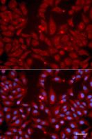 Immunofluorescence analysis of U2OS cells using GRIK2 Polyclonal Antibody