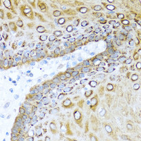 Immunohistochemistry of paraffin-embedded Human esophagus using S100A7 Polyclonal Antibody at dilution of 1:100 (40x lens) .