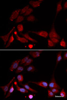Immunofluorescence analysis of U2OS cells using APBB1 Polyclonal Antibody