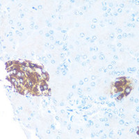 Immunohistochemistry of paraffin-embedded Rat islets of langerhans using ODC1 Polyclonal Antibody at dilution of 1:100 (40x lens) .