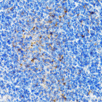 Immunohistochemistry of paraffin-embedded Mouse spleen using PSMD10 Polyclonal Antibody at dilution of 1:100 (40x lens) .