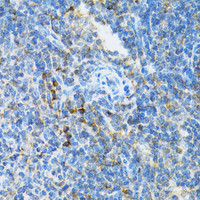 Immunohistochemistry of paraffin-embedded Mouse spleen using UBE2D1 Polyclonal Antibody at dilution of 1:100 (40x lens) .