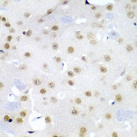 Immunohistochemistry of paraffin-embedded Mouse brain using CDC27 Polyclonal Antibody at dilution of 1:200 (40x lens) .