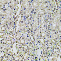 Immunohistochemistry of paraffin-embedded Rat kidney using SMARCC2 Polyclonal Antibody at dilution of 1:100 (40x lens) .