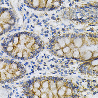 Immunohistochemistry of paraffin-embedded Human colon using PTPRA Polyclonal Antibody at dilution of 1:100 (40x lens) .