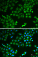 Immunofluorescence analysis of MCF-7 cells using RPL5 Polyclonal Antibody