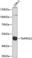 Western blot analysis of extracts of 22Rv1 cells using TMPRSS2 Polyclonal Antibody at dilution of 1:2000.