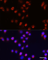 Immunofluorescence analysis of A431 cells using ACVR2A Polyclonal Antibody at dilution of 1:100 (40x lens) . Blue: DAPI for nuclear staining.