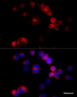 Immunofluorescence analysis of HeLa cells using CYP27A1 Polyclonal Antibody at dilution of 1:100 (40x lens) . Blue: DAPI for nuclear staining.