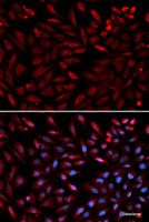 Immunofluorescence analysis of U2OS cells using PSMC2 Polyclonal Antibody