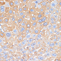 Immunohistochemistry of paraffin-embedded Mouse liver using APCS Polyclonal Antibody at dilution of 1:100 (40x lens) .