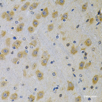 Immunohistochemistry of paraffin-embedded Rat brain using IGFBP4 Polyclonal Antibody at dilution of 1:100 (40x lens) .