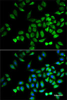 Immunofluorescence analysis of A-549 cells using ANGPTL4 Polyclonal Antibody