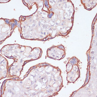 Immunohistochemistry of paraffin-embedded Human placenta using NT5E / CD73 Polyclonal Antibody at dilution of 1:200 (40x lens) .