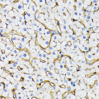 Immunohistochemistry of paraffin-embedded Human liver using NT5E / CD73 Polyclonal Antibody at dilution of 1:200 (40x lens) .