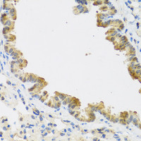 Immunohistochemistry of paraffin-embedded Mouse lung using CDKN2C Polyclonal Antibody at dilution of 1:100 (40x lens) .