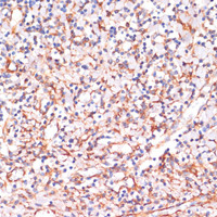 Immunohistochemistry of paraffin-embedded Human tonsil using IKK alpha Polyclonal Antibody at dilution of 1:100 (40x lens) .