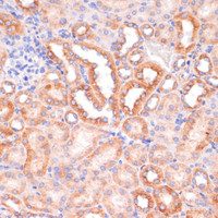 Immunohistochemistry of paraffin-embedded Mouse kidney using IKK alpha Polyclonal Antibody at dilution of 1:100 (40x lens) .