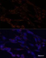 Immunofluorescence analysis of NIH/3T3 cells using IKK alpha Polyclonal Antibody at dilution of 1:100. Blue: DAPI for nuclear staining.