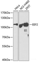 Western blot analysis of extracts of various cell lines using EEF2 Polyclonal Antibody at dilution of 1:500.