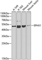 Western blot analysis of extracts of various cell lines using EPHX1 Polyclonal Antibody at dilution of 1:1000.