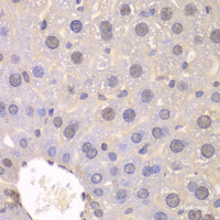 Immunohistochemistry of paraffin-embedded Mouse liver using FGFR1 Polyclonal Antibody at dilution of 1:100 (40x lens) .