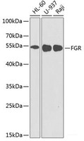 Western blot analysis of extracts of various cell lines using FGR Polyclonal Antibody at dilution of 1:1000.