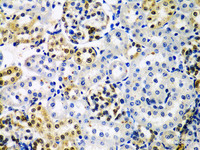 Immunohistochemistry of paraffin-embedded Rat kidney using HDAC2 Polyclonal Antibody at dilution of 1:100 (40x lens) .