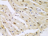 Immunohistochemistry of paraffin-embedded Mouse heart using HDAC2 Polyclonal Antibody at dilution of 1:100 (40x lens) .