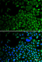 Immunofluorescence analysis of A549 cells using HDAC2 Polyclonal Antibody