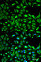 Immunofluorescence analysis of A-549 cells using IGF2 Polyclonal Antibody