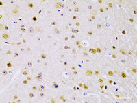 Immunohistochemistry of paraffin-embedded Mouse brain using IKK beta Polyclonal Antibody at dilution of 1:100 (40x lens) .