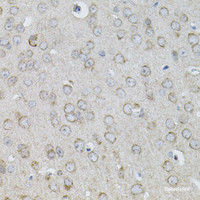 Immunohistochemistry of paraffin-embedded Mouse brain using IL13 Polyclonal Antibody