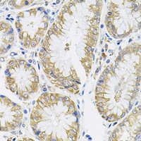 Immunohistochemistry of paraffin-embedded Human stomach using IL13 Polyclonal Antibody