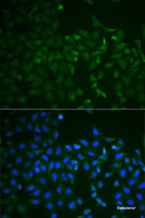 Immunofluorescence analysis of HeLa cells using TNFRSF11B Polyclonal Antibody