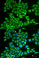 Immunofluorescence analysis of U2OS cells using PDE1B Polyclonal Antibody
