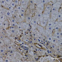 Immunohistochemistry of paraffin-embedded Human liver damage using CD31 Polyclonal Antibody at dilution of 1:100 (40x lens) .