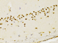 Immunohistochemistry of paraffin-embedded Rat brain using PTEN Polyclonal Antibody at dilution of 1:200 (40x lens) .