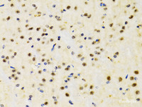 Immunohistochemistry of paraffin-embedded Mouse brain using PTEN Polyclonal Antibody at dilution of 1:200 (40x lens) .